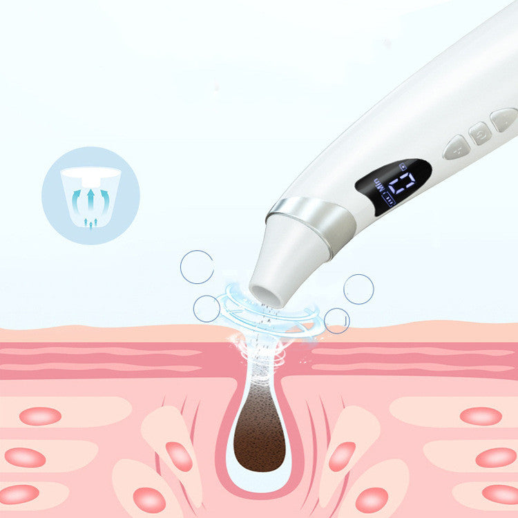 Electric Blackhead Remover & Pore Cleaner – Skin Care Tool